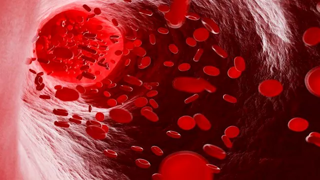 مرضى الأنيميا                                     