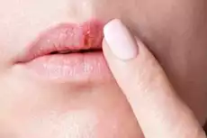 الشفاه مرآة صحتك.. علامات لا تتجاهلها