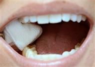 لماذا تناول المثلجات مفيد بعد خلع الضرس؟