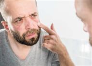 بماذا تخبرك عيناك عن صحتك؟