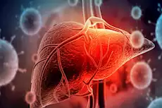 للوقاية من التهاب الكبد الوبائي- اتبع هذه النصائح 