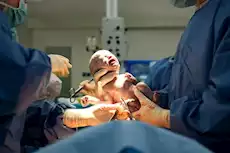 تضخم الكلى عند الجنين.. إليك الأسباب وطرق العلاج