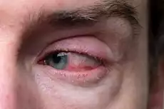 صورة تعبيرية