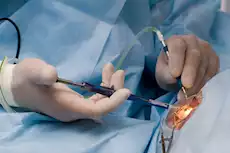 5 علامات تدل على ضرورة إجراء عملية المياه البيضاء       
