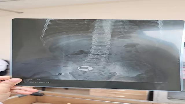 صورة الأشعة