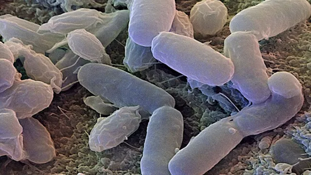 أضرار البكتيريا المنزلية على صحتنا