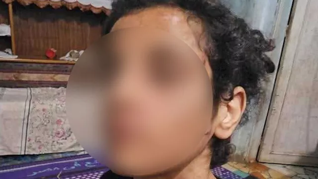 مأساة طفلة عذبها والدها وزوجته بالمنوفية