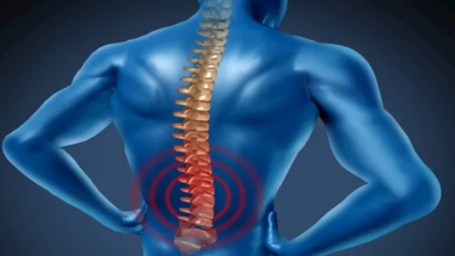 ضمور العضلات الشوكي