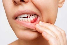تعاني حساسية الأسنان؟ إليك علاجات منزلية لصحة الفم