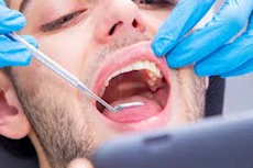  ضرس العقل المدفون - طبيب يحذر من هذه المضاعفات 