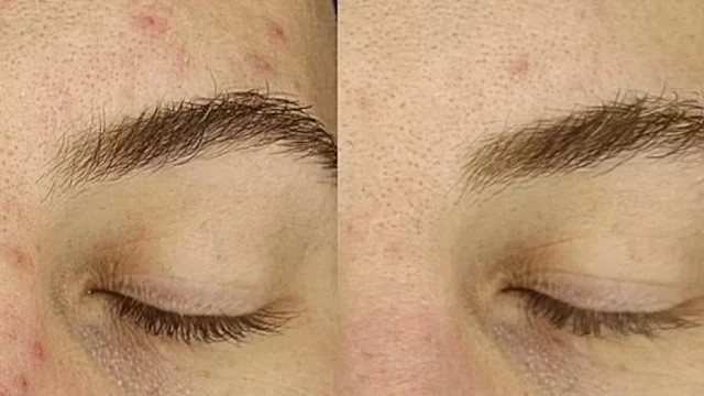 ثورة في عالم البشرة.. قناع ليلي قد يزيل التصبغات و