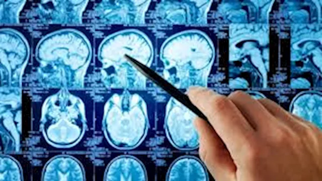 تشخيص أورام الدماغ
