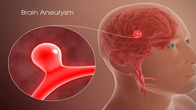 Headline احذر.. أعراض محتملة لـ تمدد الأوعية الدمو