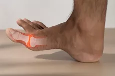 طقطقة أصابع القدم.. علام يدل؟                            