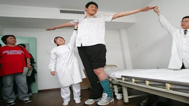 منها الطول.. عوامل تؤثر على نمو الإنسان