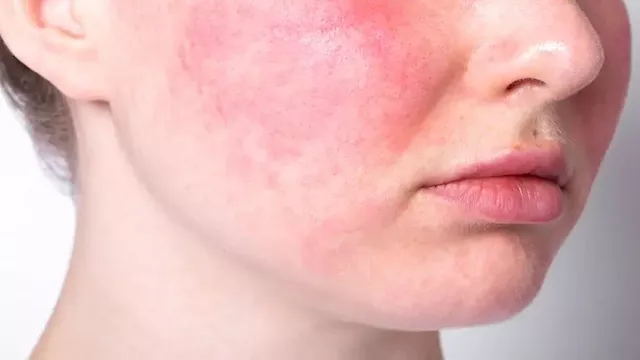 صورة تعبيرية