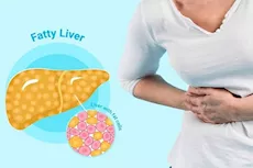 للنساء- 9 أشياء تعرضِك للإصابة بمرض الكبد الدهني