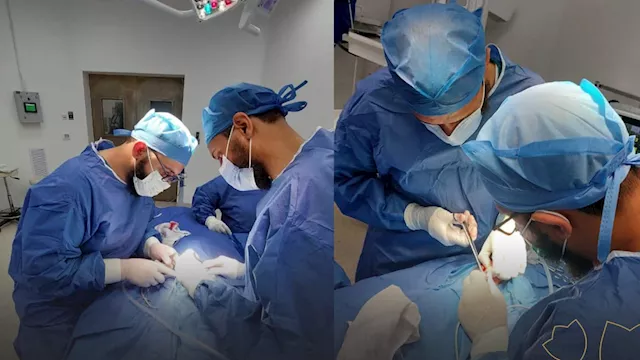 الفريق الطبي خلال اجراء العملية