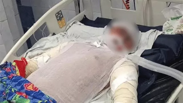  بطل حريق شبرا الخيمة