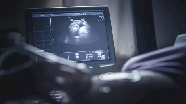 بعد 18 عاما من الانتظار.. الذكاء الاصطناعي يحقق حل