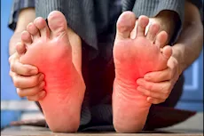 5 أسباب للشعور بحرقان في القدم.. اعرفها