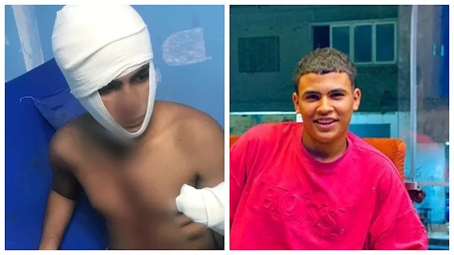 بتر أصابع طالب في مشاجرة على هاتف محمول بشبرا الخي