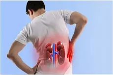 8 عادات تؤذي الكلى- احذرها