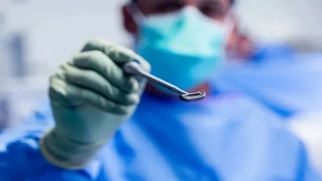 إنجاز طبي.. أول جراحة في العالم للعمود الفقري بغرس