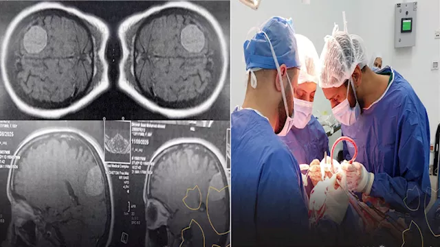نجاح جراحتين دقيقتين لاستئصال ورم بالمخ وتثبيت فقر