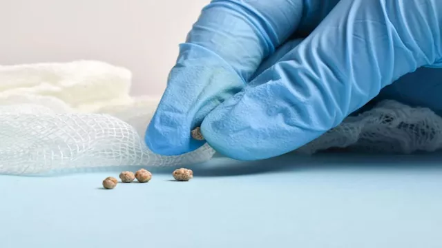 علامات بسيطة