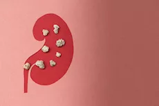 احذر- خضراوات تسبب حصوات الكلى