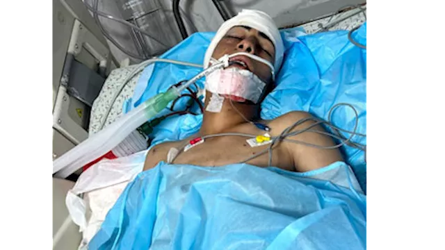 محمد نعيم عوض الذي أصيب برصاص الاحتلال