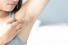 5 طرق طبيعية للتخلص من اسمرار الإبط المزعجة