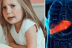 احذري- 6 أعراض تكشف إصابة طفلِك بدهون الكبد