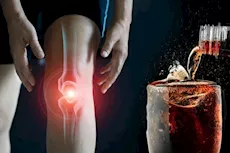 ماذا يحدث لعظامك عند تناول المشروبات الغازية يوميًا؟