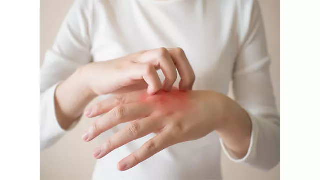 تورم أصابع اليدين