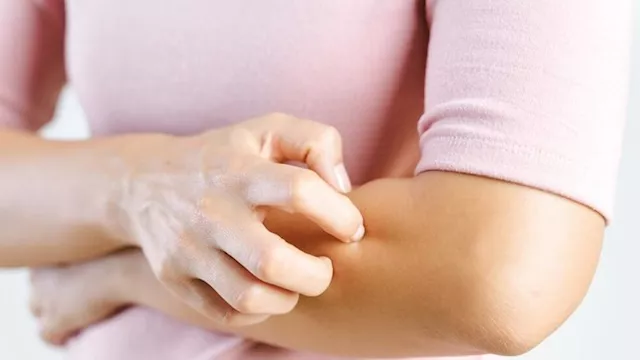 ارتفاع معدلات الإصابة بـالجرب في أوروبا