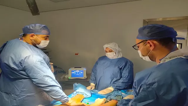 إجراء عملية دوالي الساقين بتقنية التردد الحراري بـ