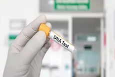 ما هي علاقة تحليل DNA وفقدان الوزن؟