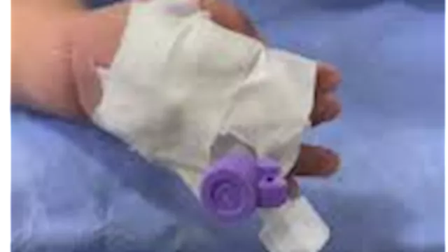 الطفل الرضيع