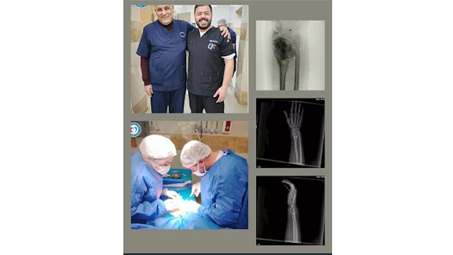 نجاح عملية جراحية دقيقة في منوف