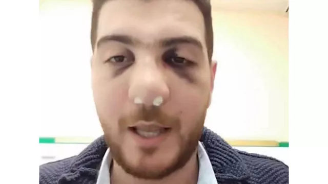 فيديو يكشف تطورات جديدة في مشاجرة طبيب الباجور