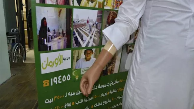 تسليم أجهزة تعويضية وسماعات طبية مجانية للأسر غير 