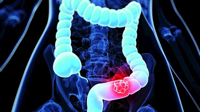 صحة القولون