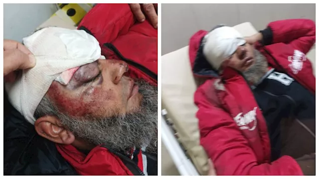 هجوم كلاب ضالة يصيب مُسنًا في بورسعيد