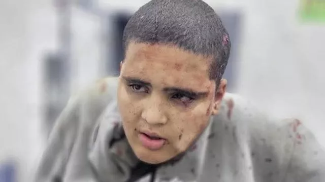 سقوط طفل من ذوي الاحتياجات الخاصة من قطار