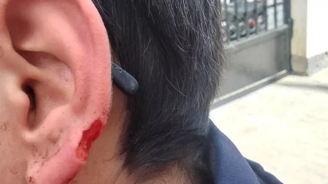 طالب يفقد جزءًا من أذنه بمدرسة بالإسكندرية 