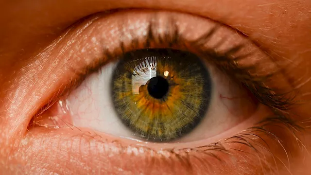 حرقان العين