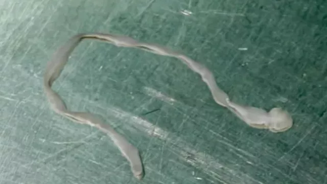 دودة بطول 8 سم 