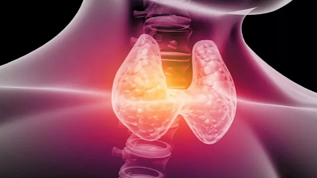 قصور الغدة الدرقية